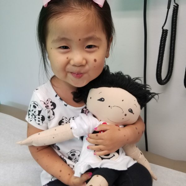 overjoyed child holding doll with matching birth marks