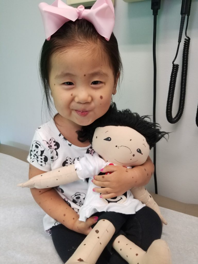 overjoyed child holding doll with matching birth marks