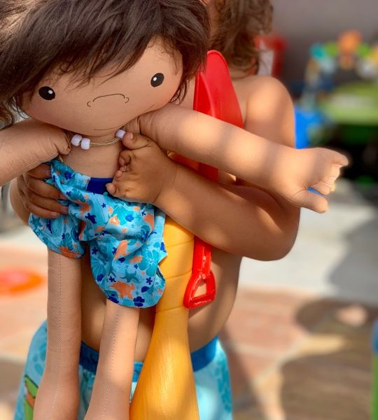 sweet child with underdeveloped hand showing their matching doll